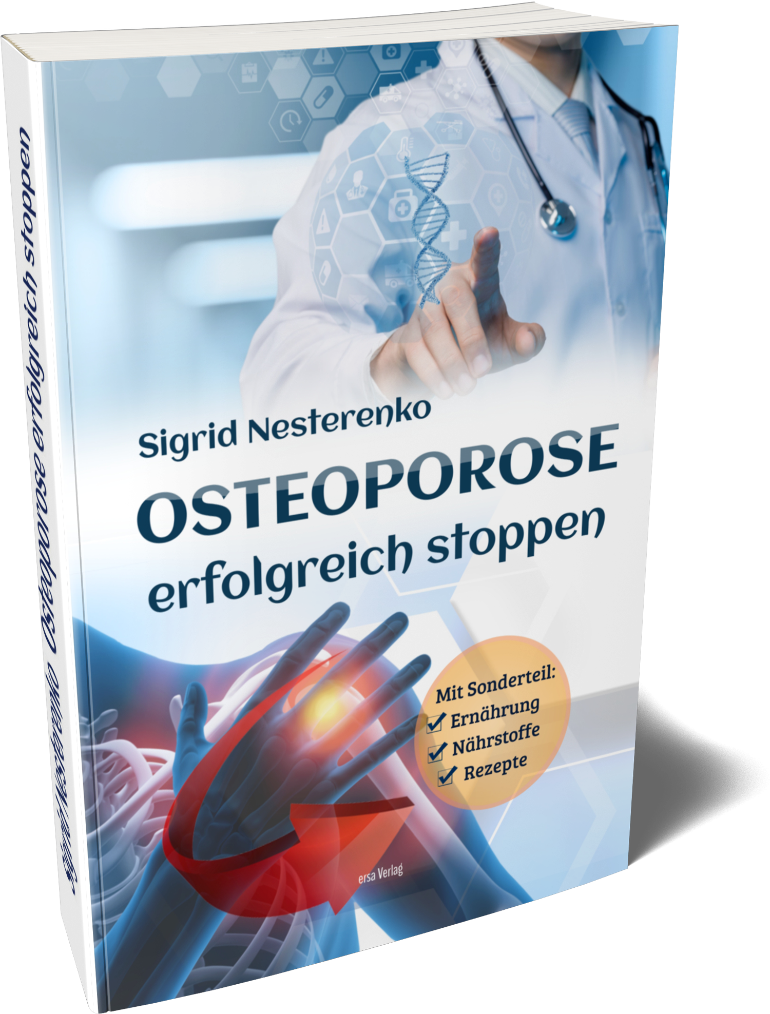Osteoporose